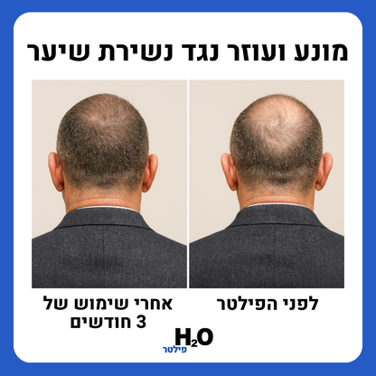 ראש המקלחת של H2O - עור ושיער בריאים יותר מהמקלחת הראשונה