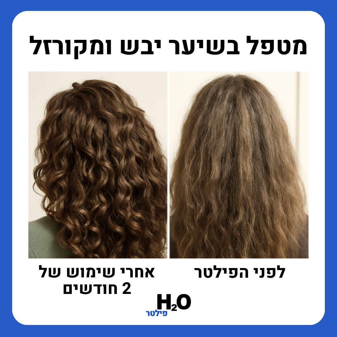 פילטר המים של H2O – משקם את העור והשיער