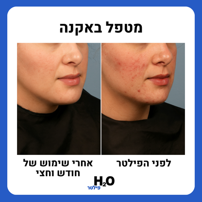 ראש המקלחת של H2O - עור ושיער בריאים יותר מהמקלחת הראשונה